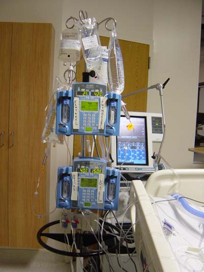 腎臓移植後の病室の機械